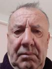 Gyula 1. párkereső fotója