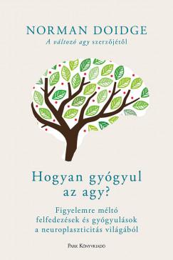 Hogyan gyógyul az agy? (Norman Doidge) könyv